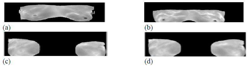 Samples of Images in MRI Dataset (a) MRI Image 1 (b) MRI Image 2 (c) MRI Image 3 (d) MRI Image 4